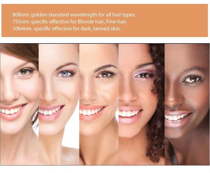 Alexandrite Laser Hair Removal Machine