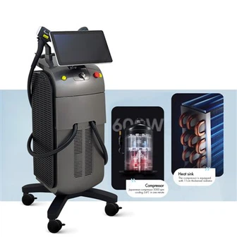 Jäätymispisteen Soprano Titanium -karvojenpoiston edut