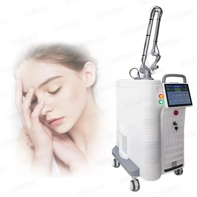 Co2-laserpinnoituskoneen hinta