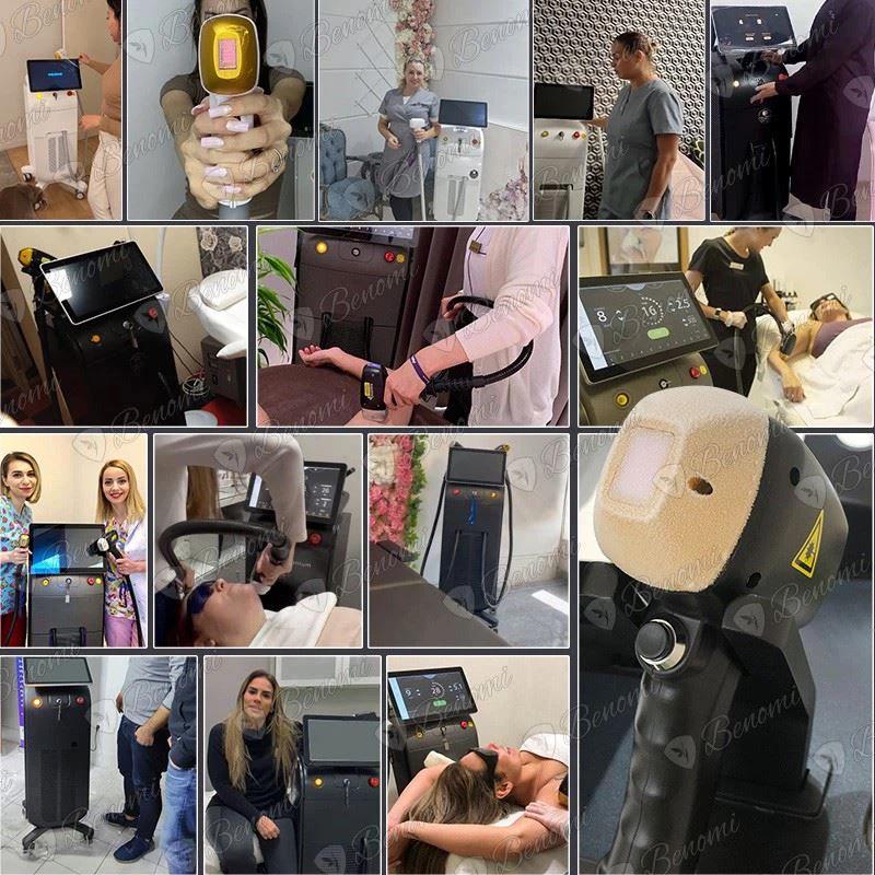 Soprano Titanium Fast, Laser Hair Removal Machine suppliers